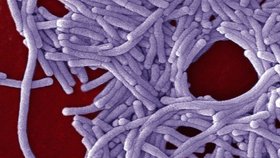 Bakterie Legionelly