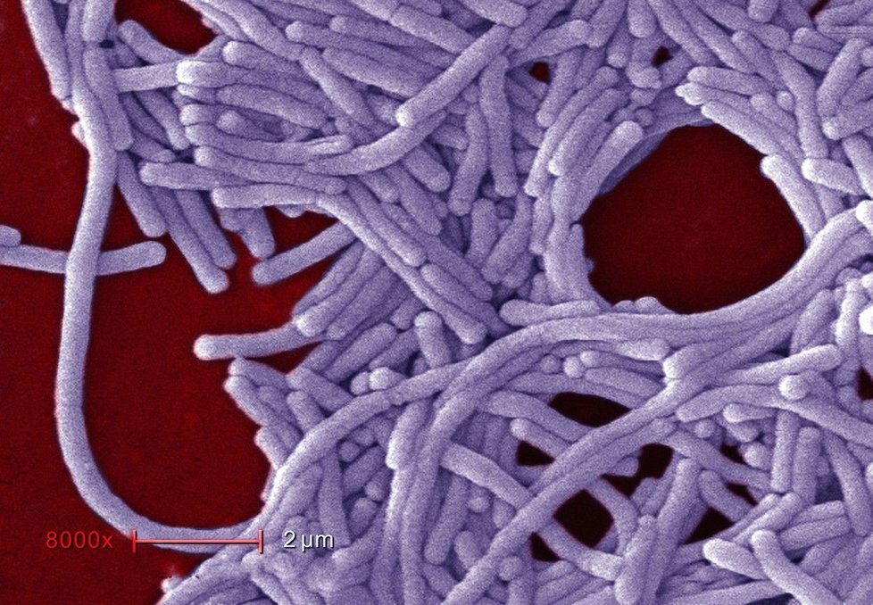 Bakterie rodu Legionella