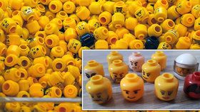 Pediatři spolkli hlavičku LEGO panáčka. Za jak dlouho a v jakém stavu vyšla ven?