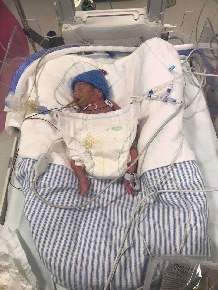 Chlapec se narodil o 17 týdnů dříve: Lékaři ho nacpali do igelitového sáčku naplněného kyslíkem
