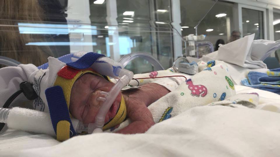Chlapec se narodil o 17 týdnů dříve: Lékaři ho nacpali do igelitového sáčku naplněného kyslíkem