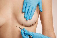 Světově v plastických operacích vede zvětšování prsou
