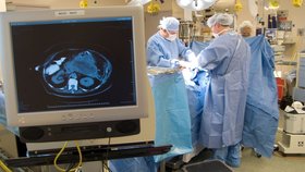 Slinivka břišní měří mezi 16 a 22 centimetry a váží okolo 80 gramů, leží mezi žaludkem a dvanácterníkem.