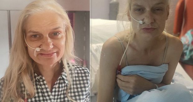 Ženu pálila žáha a lékaři to ignorovali: Nakonec ji zjistili nádor ve čtvrtém stádiu  