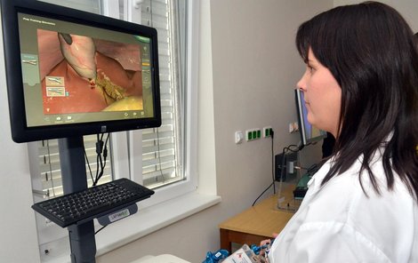 Lékařka Jana Kudělková se na simulátoru Simbionix učí operovat žlučník.
