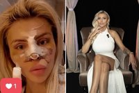 Vémolova Lela po plastice nosu v Íránu: Musela opět na sál!