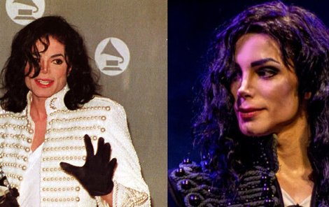 Je od Michaela Jacksona téměř k nerozeznání.