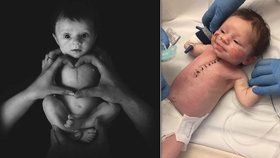 Lékaři řekli rodičům, že jejich malý Leo se čtyřmi poruchami srdce nemusí přežít. Chlapec všechny překvapil a 3 měsíce po náročném zákroku se má čile k světu.