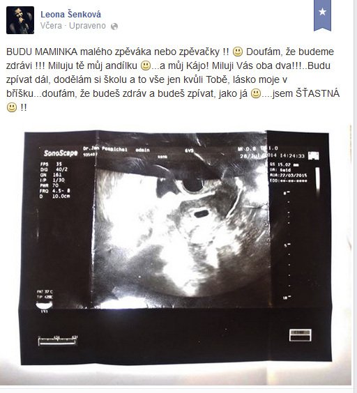 Leona Šenková se pochlubila snímkem z ultrazvuku.