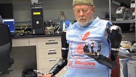 Američan, který před více než 40 lety přišel o obě ruce, se nyní učí ovládat nové robotické paže