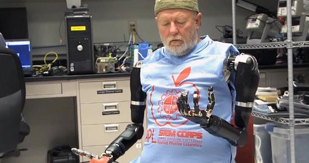 Američan, který před více než 40 lety přišel o obě ruce, se nyní učí ovládat nové robotické paže