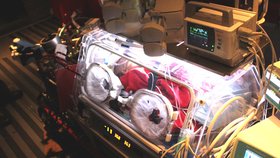 Čeští lékaři zachránili život tříměsíčnímu miminku