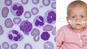 V Ústavu hematologie a krevní transfuze lékaři vyléčili mladého muže (27) s akutní lymfoblastovou leukemií. Před léčbou se jeho šance na přežití přitom počítaly v týdnech.