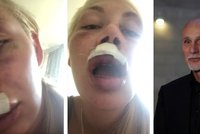 Exkluzivně pro Blesk! Napadená milenka mecenáše Motoristů Chlada: Důkazy jeho brutálního útoku!
