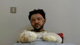 Nemocnice v Benghazi: Muhammed al Naser řídil sanitku, když ho zasáhla jedna z bomb, kterou svrhla Kaddáfího armáda