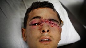 Další civilista, který leží v nemocnici v Benghazi. Zraněn byl při útoku Kaddáfího vojáků.