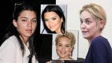 Hollywood bez make-upu: Jak se na slavných tvářích vyřádila příroda? Jsou k nepoznání