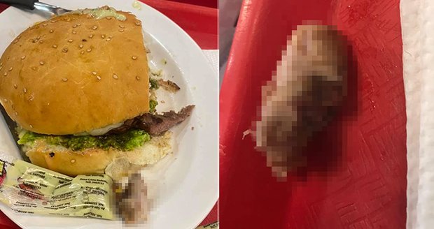 Odporný nález v rychlém občerstvení: Žena našla v hamburgeru lidský prst
