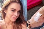 Herečka Lindsay Lohan (30) přišla o kus prstu.