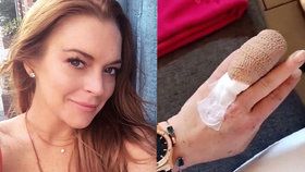 Herečka Lindsay Lohan (30) přišla o kus prstu.