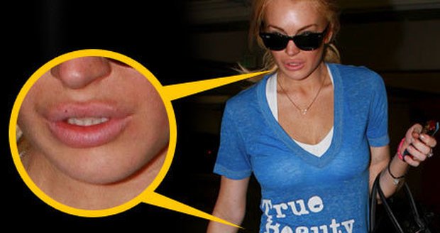 Lindsay Lohan se po píchnutí botoxu do rtů objevila s nápisem na tričku: "Pravá krása je uvnitř"
