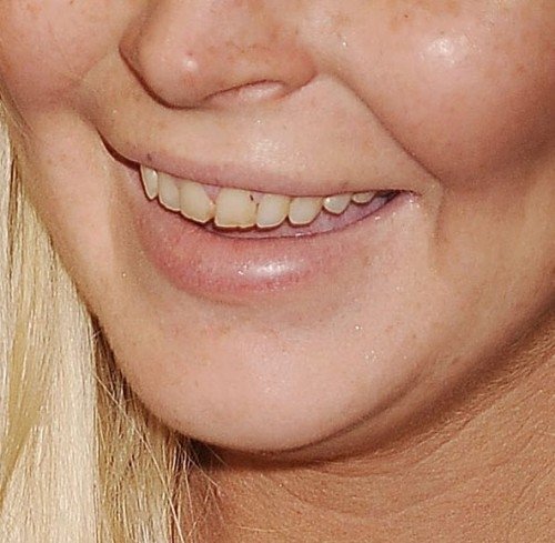 Lindsay Lohan má zuby jako stará babička