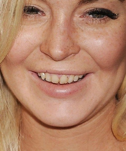 Lindsay měla ještě minulý týden zuby žluté