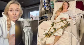 Nečekaný krok Vonnové po těžkém zranění: Proč sdílela intimní záběry? Nečekaný krok Vonnové po těžkém zranění: Proč sdílela intimní záběry?