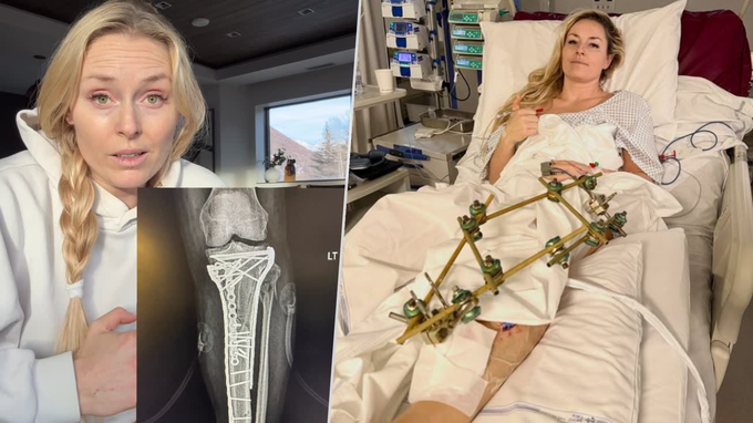 Nečekaný krok Vonnové po těžkém zranění: Proč sdílela intimní záběry? Nečekaný krok Vonnové po těžkém zranění: Proč sdílela intimní záběry?