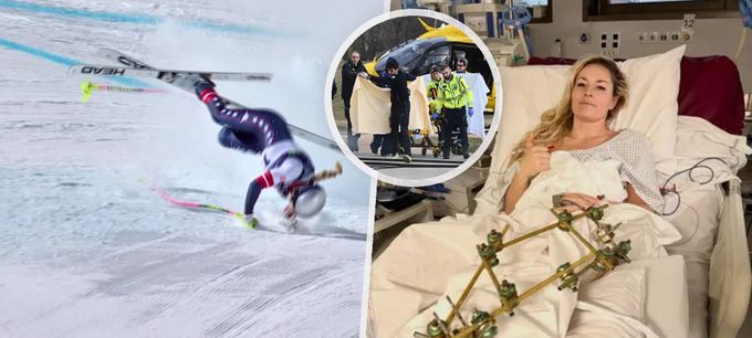 Vonnová se ozvala z nemocnice: Co děsivá fotka prozradila o jejím stavu! Vonnová se ozvala z nemocnice: Co děsivá fotka prozradila o jejím stavu!