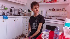 Lisa Pauli téměř 40 let bojuje s anorexií, nyní se chystá podstoupit asistovanou sebevraždu.