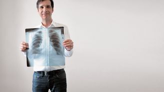 Vyměnit v člověku nemocné plíce za zdravé je radost, říká chirurg Robert Lischke