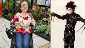 Liz Carr napadl šílenec, kterého popsala jako Střihorukého Edwarda.