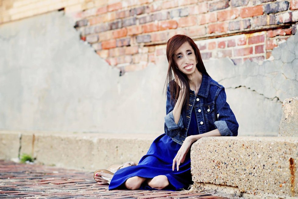 Lizzie Velasquez si se svým vzhledem těžkou hlavu nedělá...