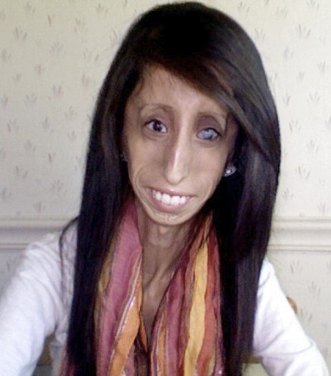 Lizzie Velasquez si se svým vzhledem těžkou hlavu nedělá...