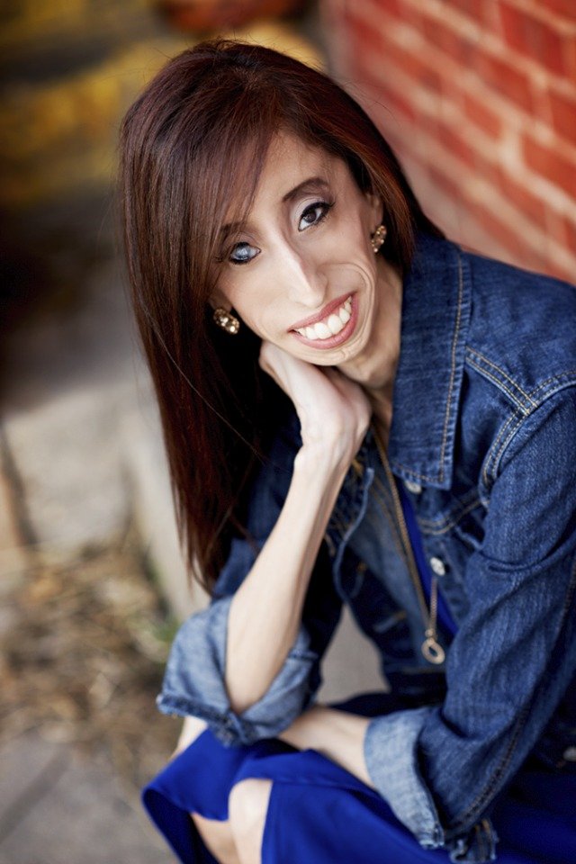 Lizzie Velasquez si se svým vzhledem těžkou hlavu nedělá...