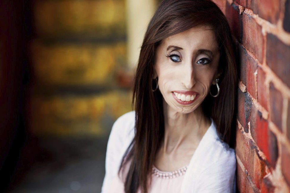 Lizzie Velasquez si se svým vzhledem těžkou hlavu nedělá...