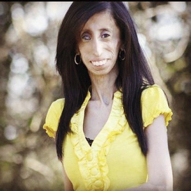 Lizzie Velasquez si se svým vzhledem těžkou hlavu nedělá...