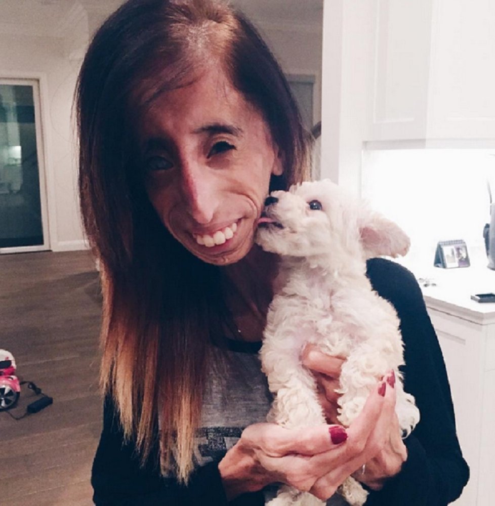 Lizzie Velasquez si se svým vzhledem těžkou hlavu nedělá...