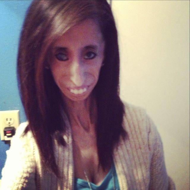 Lizzie Velasquez