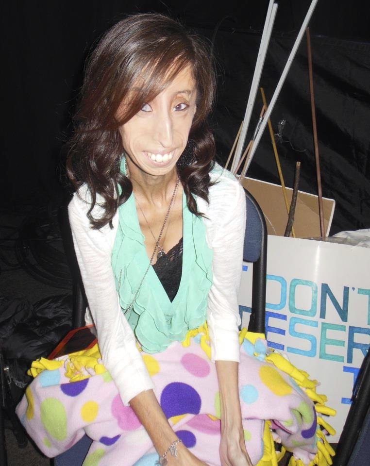 Lizzie Velasquez