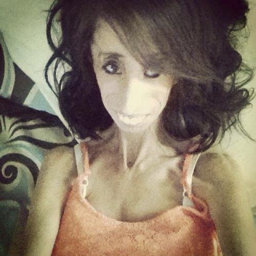 Lizzie Velasquez