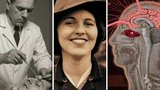 Zapomenutá hrůza jménem lobotomie: Kterým osobnostem zničila život?