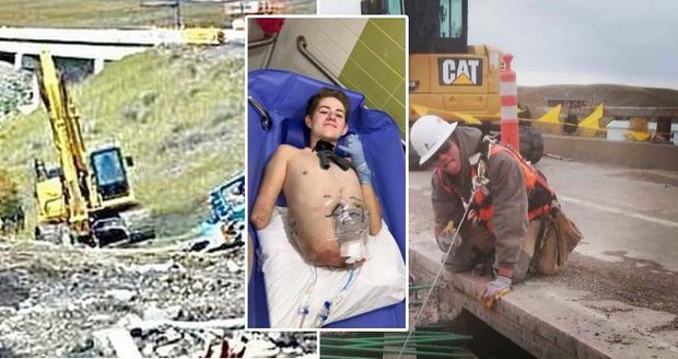 Chlapci po nehodě amputovali polovinu těla: Na fotce ukázal zkázu z okamžiku neštěstí
