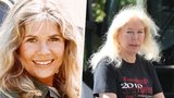 „Šťabajzna“ z M*A*S*He slaví 85: Plastikami si zničila krásu!