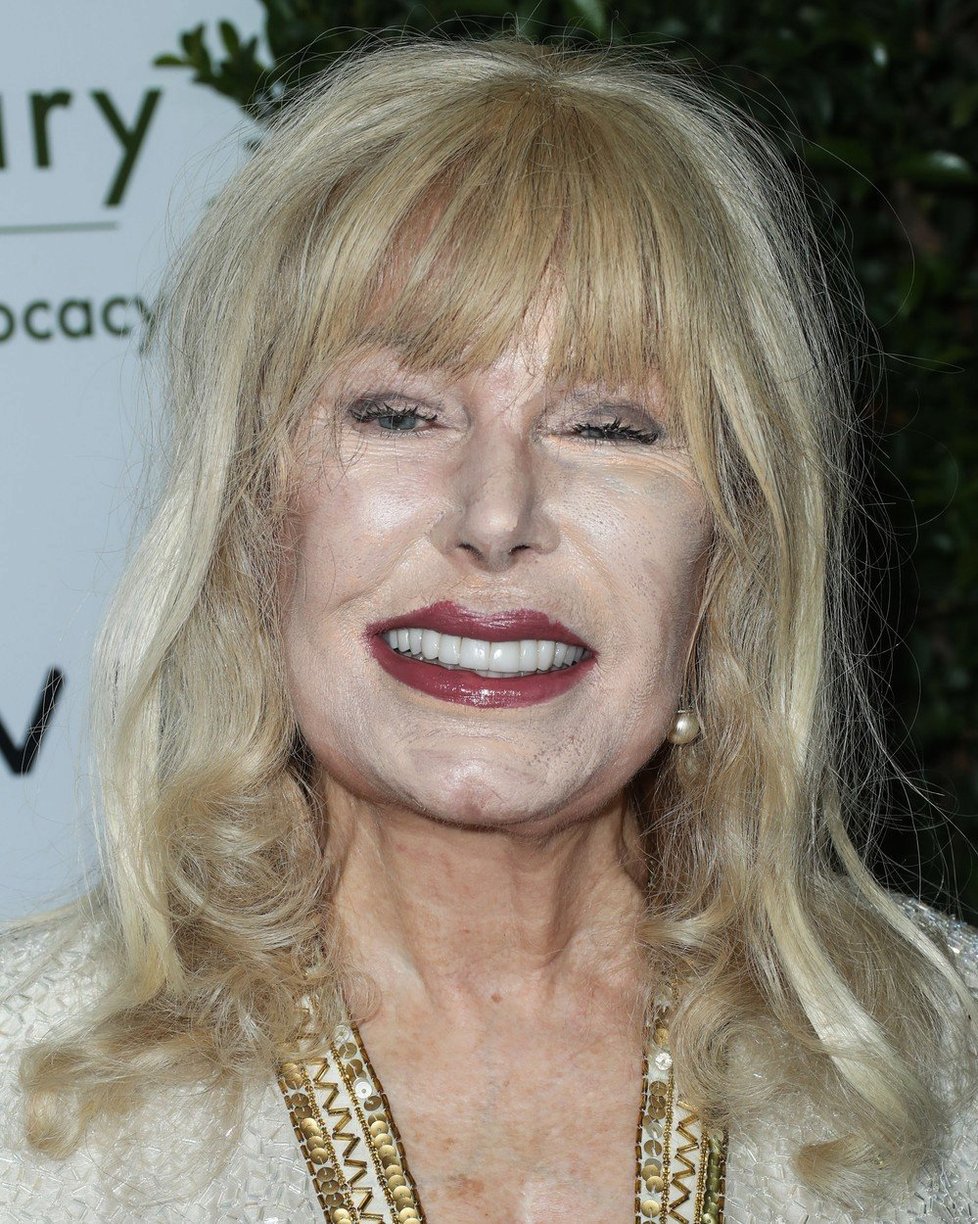 Loretta Swit po plastikách