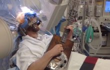 Pacient hrál během operace mozku na kytaru: Nemocnice show přenášela online!