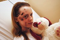 Janu (15) srazil řidič a ujel. Naštěstí přišla pomoc