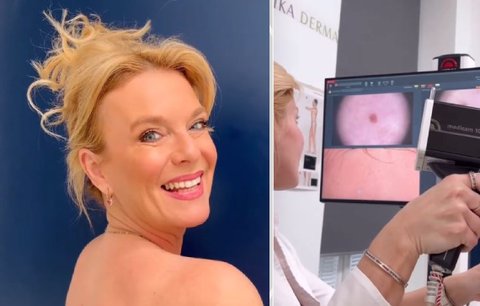 Herečka Lucie Benešová na vyšetření: Strach z melanomu!