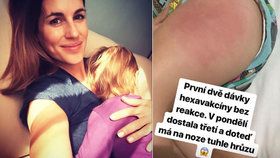 Dcerka (19 měs.) Lucie Křížkové: Ošklivá reakce na očkování!
